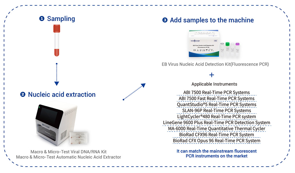 Kit de detección de ácidos nucleicos do virus EB (PCR de fluorescencia) 6